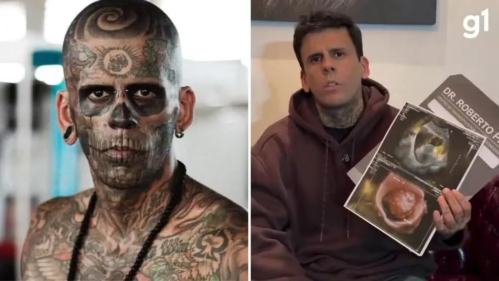 'Mais tatuado do Brasil' compartilha diagnóstico de 'câncer maligno agressivo' e diz que precisará retirar bexiga
